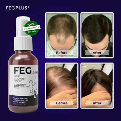 Orignal FEG Plus Hair Growth Spray