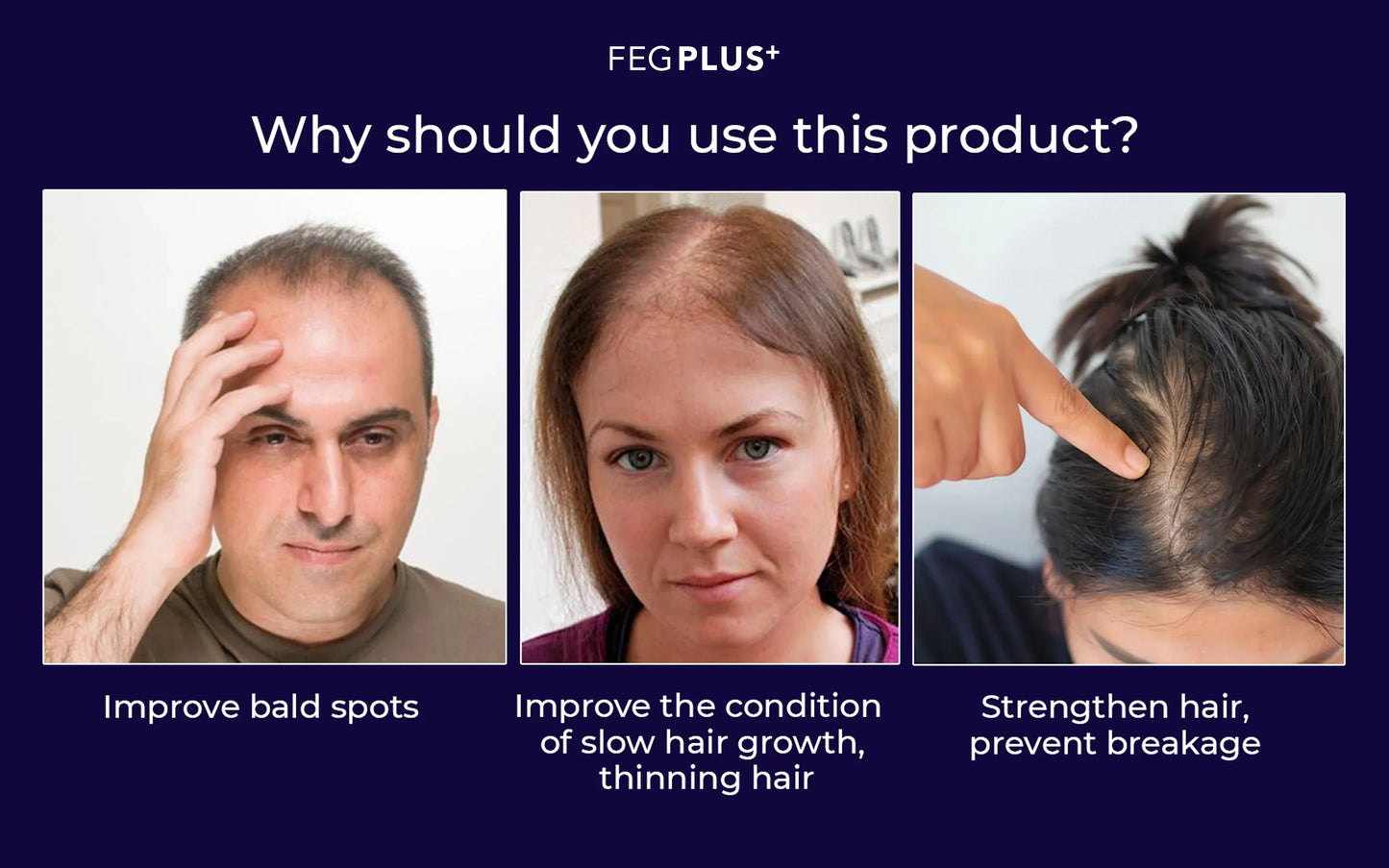 Orignal FEG Plus Hair Growth Spray