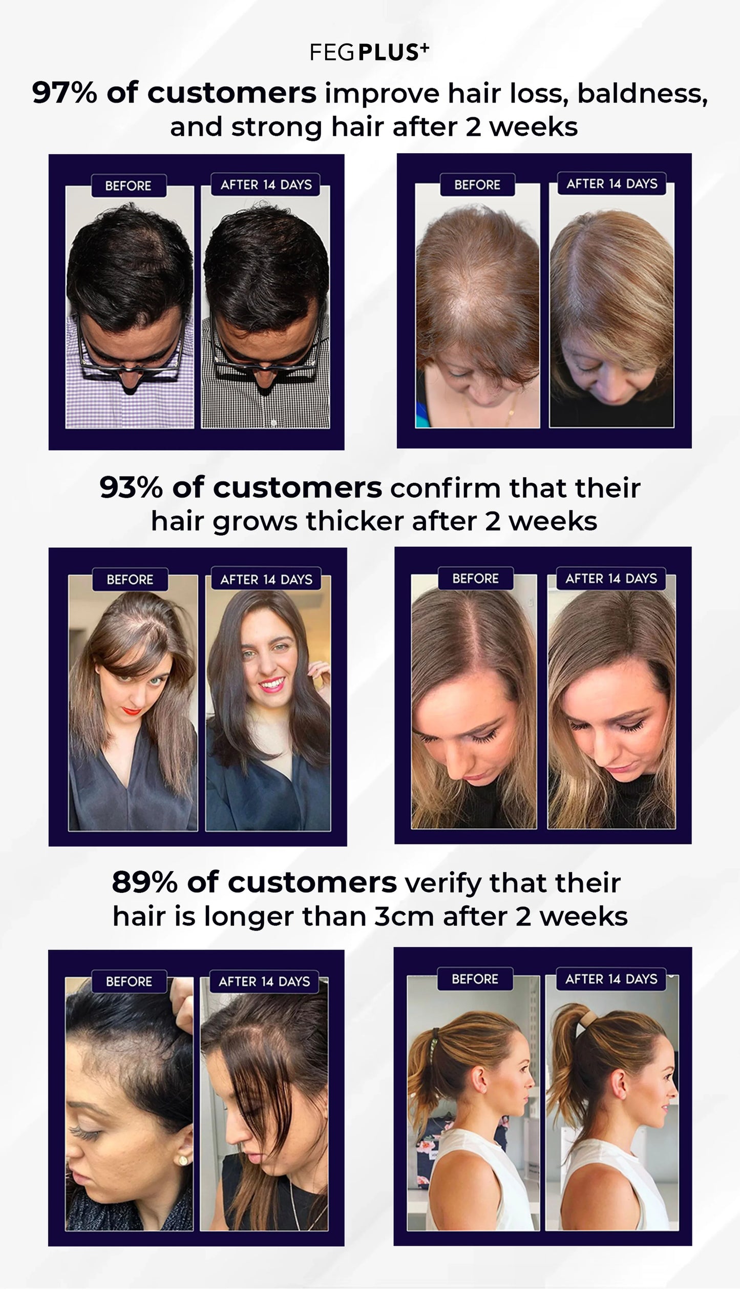 Orignal FEG Plus Hair Growth Spray